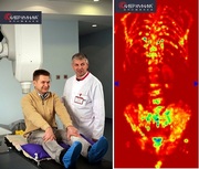 лучевая терапия, лечение рака, радиохирургия